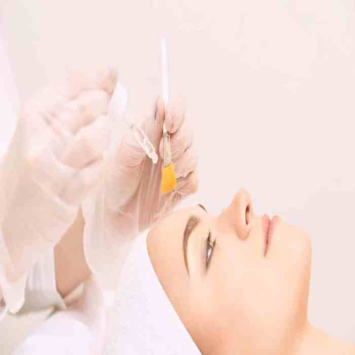 When performing an enzyme peel an esthetician should look for